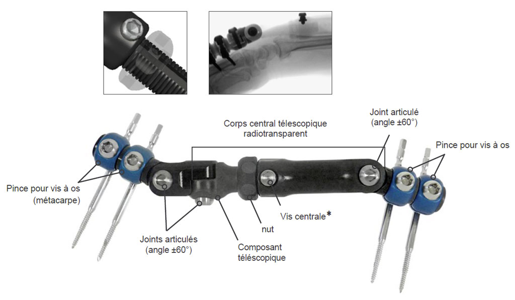 procédure pour le kit de fixation externe