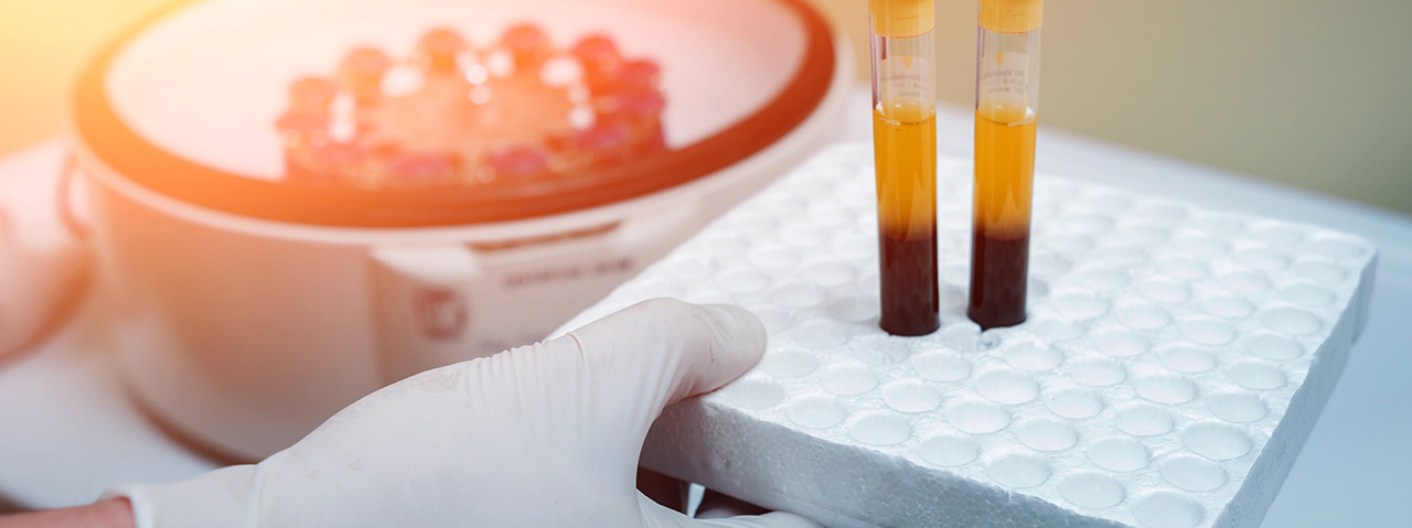 Centrifugation