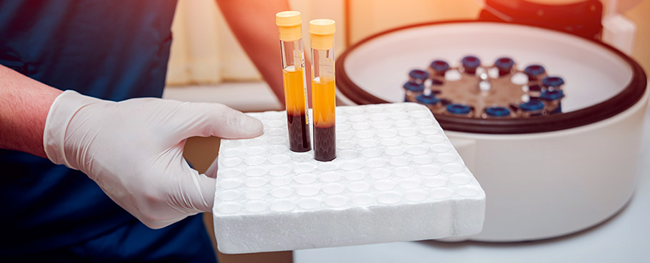 Tubes PRP et centrifugeuses