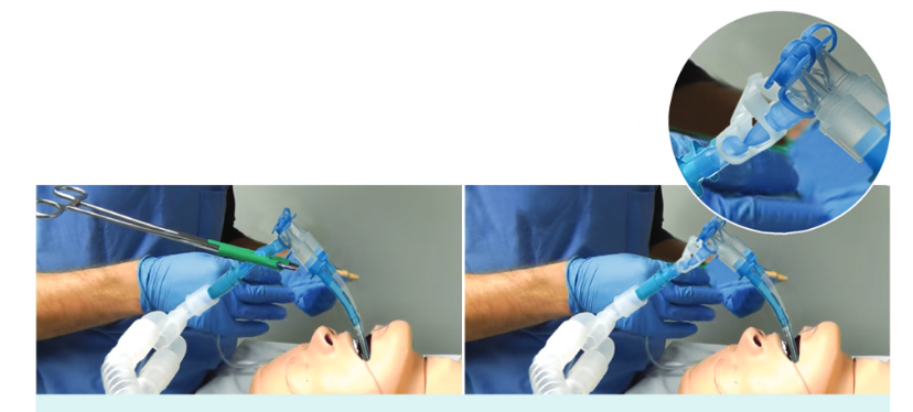 Sonde endo-bronchique double lumen